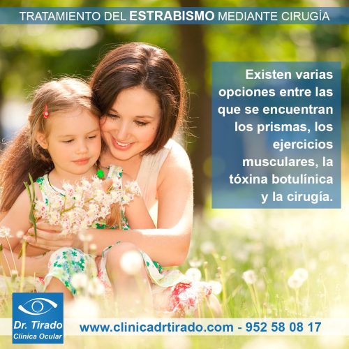 El Estrabismo Tiene Solución | Clínica Dr. Tirado